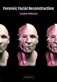 Bild vom Artikel Forensic Facial Reconstruction vom Autor Caroline Wilkinson