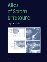 Produktbild: Atlas of Scrotal Ultrasound