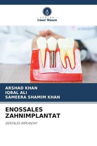 Produktbild: Enossales Zahnimplantat