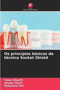 Produktbild: Os princ&iacute;pios b&aacute;sicos da t&eacute;cnica Socket Shield