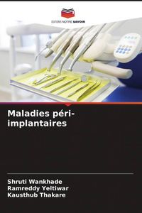 Produktbild: Maladies p&eacute;ri-implantaires