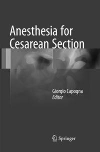 Produktbild: Anesthesia for Cesarean Section