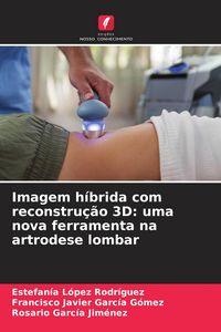 Produktbild: Imagem h&iacute;brida com reconstru&ccedil;&atilde;o 3D: uma nova ferramenta na artrodese lombar