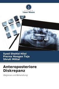 Produktbild: Anteroposteriore Diskrepanz