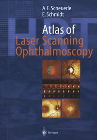 Produktbild: Atlas of Laser Scanning Ophthalmoscopy