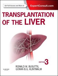 Produktbild: Busuttil, R: Transplantation of the Liver