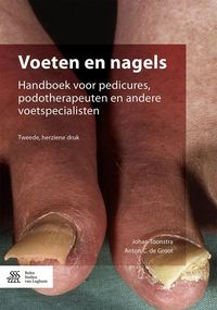 Produktbild: Voeten en nagels