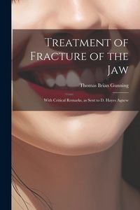 Produktbild: Treatment of Fracture of the Jaw; With Critical Remarks, as Sent to D. Hayes Agnew