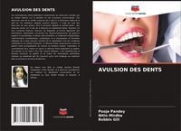 Produktbild: Avulsion des Dents