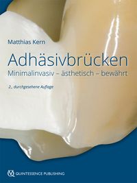 Bild vom Artikel Adhäsivbrücken vom Autor Matthias Kern