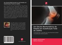 Produktbild: Um Estudo Morfom&eacute;trico de Patella em Substitui&ccedil;&atilde;o Total do Joelho