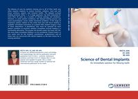 Produktbild: Science of Dental Implants