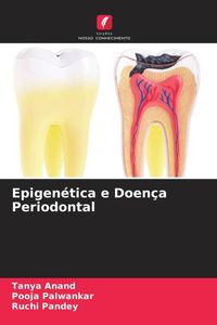 Produktbild: Epigen&eacute;tica e Doen&ccedil;a Periodontal