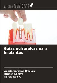Produktbild: Gu&iacute;as quir&uacute;rgicas para implantes
