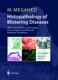 Produktbild: Histopathology of Blistering Diseases