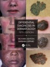 Produktbild: Ashton, R: Differential Diagnosis in Dermatology