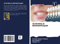 Produktbild: Jestetika V Implantacii