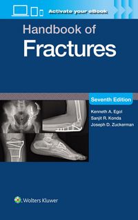Produktbild: Handbook of Fractures