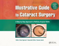 Produktbild: Illustrative Guide to Cataract Surgery