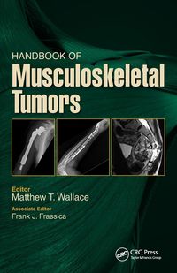 Produktbild: Handbook of Musculoskeletal Tumors