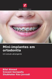 Produktbild: Mini-implantes em ortodontia