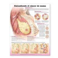 Produktbild: Understanding Breast Cancer Anatomical Chart in Spanish (Entendiendo El Cancer de Mama)