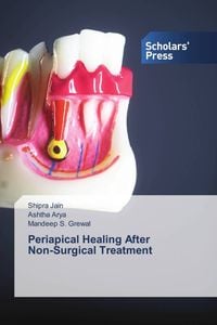 Produktbild: Periapical Healing After Non-Surgical Treatment