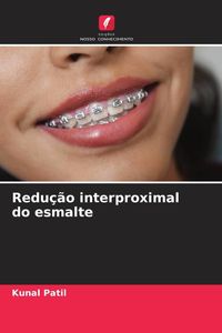 Produktbild: Redu&ccedil;&atilde;o interproximal do esmalte