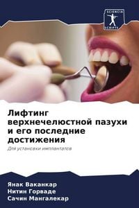 Produktbild: Lifting werhnechel&uuml;stnoj pazuhi i ego poslednie dostizheniq