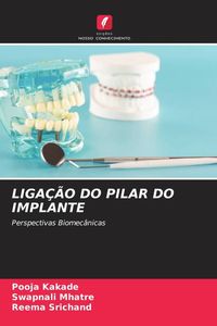 Produktbild: Liga&ccedil;&atilde;o Do Pilar Do Implante