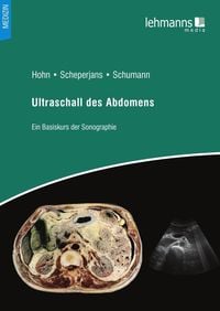 Produktbild: Ultraschall des Abdomens