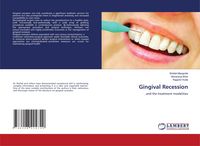 Produktbild: Gingival Recession
