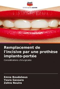 Produktbild: Remplacement de l'incisive par une proth&egrave;se implanto-port&eacute;e