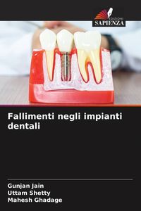 Produktbild: Fallimenti negli impianti dentali