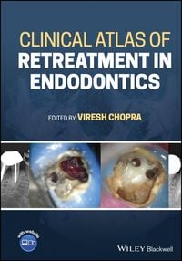 Produktbild: Clinical Atlas of Retreatment in Endodontics