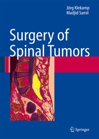 Produktbild: Surgery of Spinal Tumors