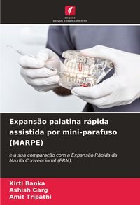 Produktbild: Expans&atilde;o palatina r&aacute;pida assistida por mini-parafuso (MARPE)