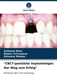 Produktbild: "CBCT-gest&uuml;tzte Implantologie: Der Weg zum Erfolg"