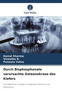 Produktbild: Durch Bisphosphonate verursachte Osteonekrose des Kiefers