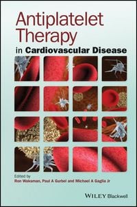 Produktbild: Antiplatelet Therapy in Cardiovascular Disease