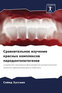 Produktbild: Srawnitel'noe izuchenie krasnyh komplexow parodontopatogenow