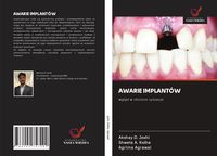 Produktbild: Awarie Implant&oacute;w