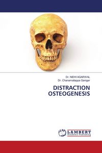 Produktbild: Distraction Osteogenesis