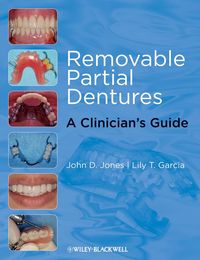 Produktbild: Removable Partial Dentures
