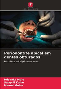 Produktbild: Periodontite apical em dentes obturados