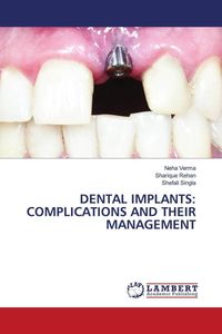 Produktbild: Dental Implants: Complications and Their Management