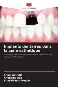 Produktbild: Implants dentaires dans la zone esth&eacute;tique