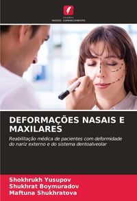 Produktbild: Deforma&ccedil;&otilde;es Nasais E Maxilares