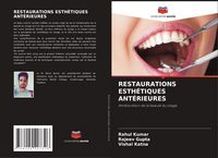 Produktbild: Restaurations Esth&eacute;tiques Ant&eacute;rieures