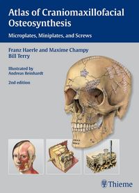 Produktbild: Atlas of Craniomaxillofacial Osteosynthesis